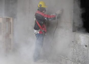 silicosis